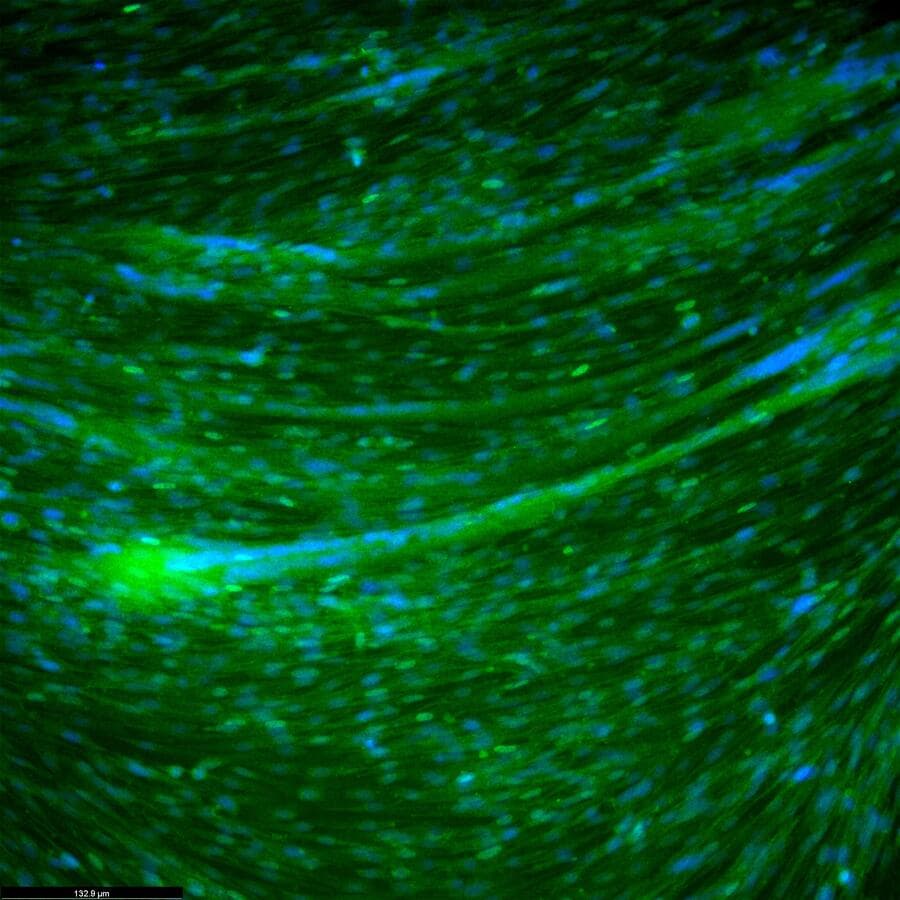 Differentiated primary chicken muscle cells stained for a muscle marker protein