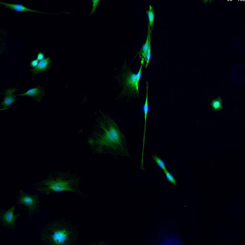 Representative C2C12 cells (a mouse myoblast cell line) stained for a muscle marker protein